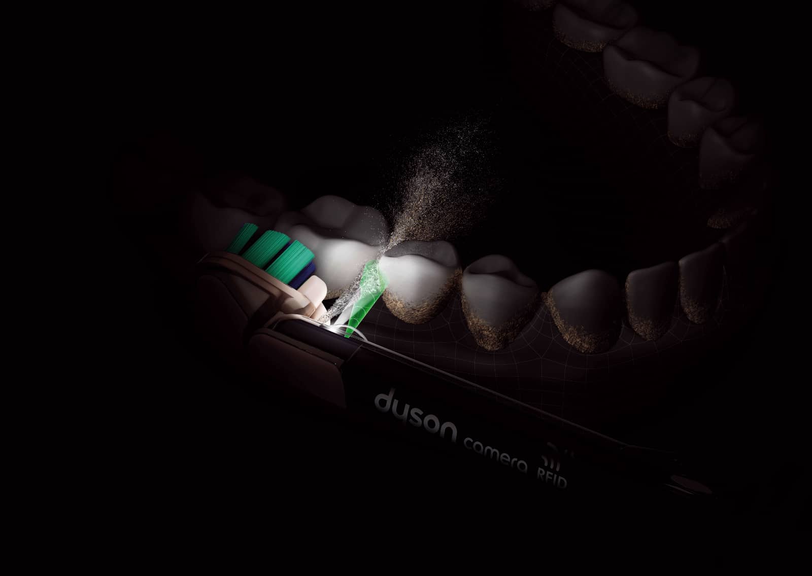 dyson-dental-camerajet-2026-07.jpg